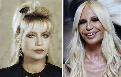 trasformazione di donatella versace|what happened to donatella versace.